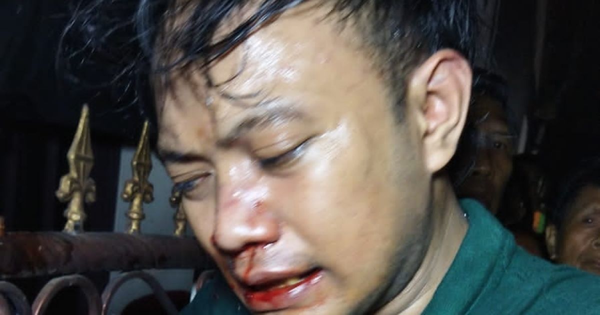 Publik Menyoroti Kaburnya Terduga Pelaku Pencurian Motor, Dan Dalam Penanganan Propam