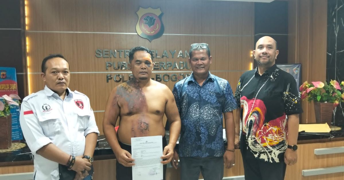 Kasus Dugaan Penganiayaan di Cileungsi Masuk Dalam Penanganan Polres Bogor